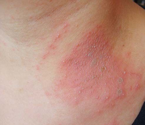 ���\�w�(y��n)�Ⱥ�